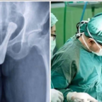 UNA NOCHE TERMINÓ EN EL HOSPITAL: IMAGEN VIRAL DESATA ADVERTENCIAS SOBRE LOS RIESGOS DE INTRODUCIR OBJETOS EN EL CUERPO